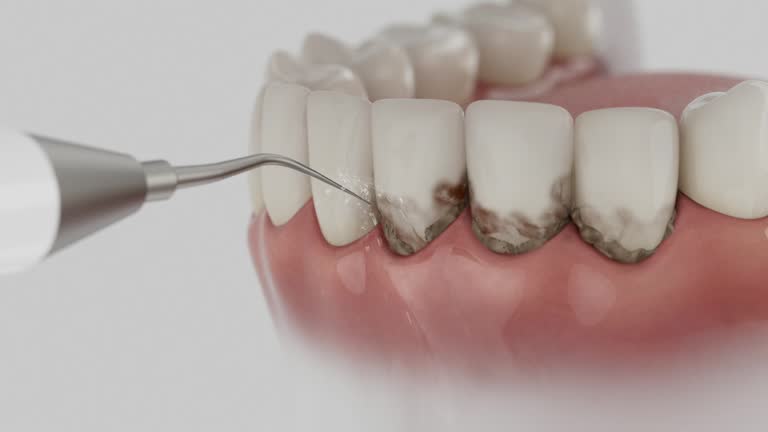 Reliable Root Canal Treatment contractor in Eddy County County, ND by Dentist Open Now